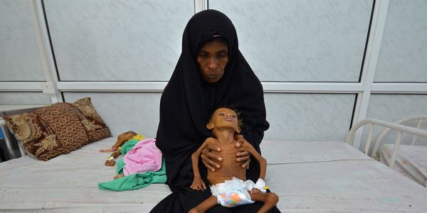 Χολέρα και πείνα απειλούν 1 εκατομμύριο ανθρώπους στην Υεμένη - Ειδήσεις Pancreta