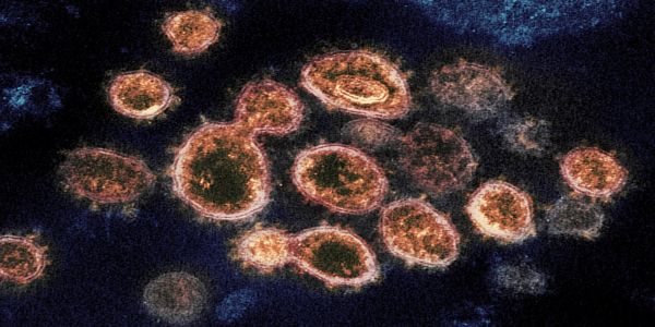 Κρήτη: 116 νέες μολύνσεις SARS-COV 2 – Αναλυτικοί πίνακες - Ειδήσεις Pancreta