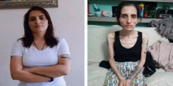 Τουρκία: Πέθανε η τραγουδίστρια Helin Bolek μετά από 288 ημέρες απεργίας πείνας - Ειδήσεις Pancreta