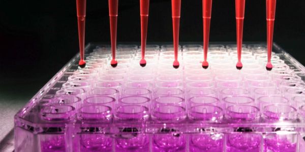 Νέο τεστ αίματος ανιχνεύει όχι μόνο τον καρκίνο, αλλά και πού αυτός αναπτύσσεται στο σώμα - Ειδήσεις Pancreta