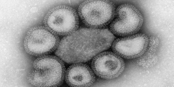 Γιατί οι ιοί προκαλούν φόβο; - Ειδήσεις Pancreta