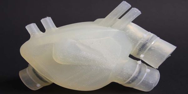 Οι 3D εκτυπωτές αλλάζουν την μεταμόσχευση οργάνων - Ειδήσεις Pancreta
