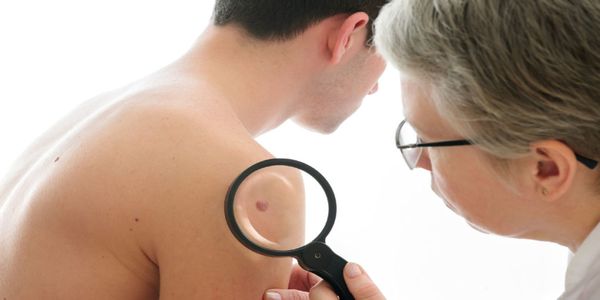 Δωρεάν εξέταση από δερματολόγους για καρκίνο δέρματος - Ειδήσεις Pancreta