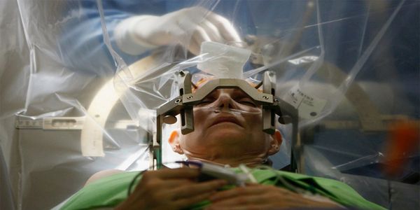 Επέμβαση στον εγκέφαλο, με τον ασθενή να συνομιλεί με τους γιατρούς - Ειδήσεις Pancreta