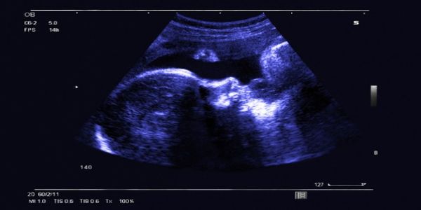 Επιστήμονες θα μπορούν να παρεμβαίνουν σε ανθρώπινα έμβρυα - Ειδήσεις Pancreta