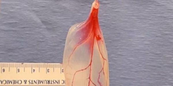 Επιστήμονες μετέτρεψαν σπανάκι σε ανθρώπινο καρδιακό ιστό (video) - Ειδήσεις Pancreta