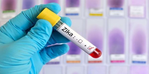 Πέρασε στην Ευρώπη ο ιός Ζίκα - Ειδήσεις Pancreta