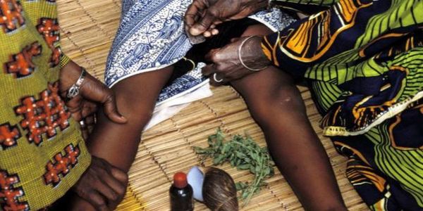 Unicef: Διακόσια εκατομύρια γυναίκες υπέστησαν κλειτοριδεκτομή το 2015 - Ειδήσεις Pancreta